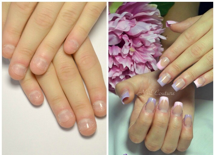 Sculpting Perfect Shape On Nail Biter S Nails Blog Records First Prep The Natural Nail Gently Push Back Cuticle Shorten Free Edge And Take Off Surface Shine With 180 Grit File